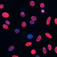 Histone H3 (Acetyl-K18) Antibody