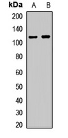 NAT10 Rabbit Polyclonal Antibody