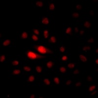 NAT10 Rabbit Polyclonal Antibody
