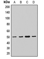 TMLHE Rabbit Polyclonal Antibody