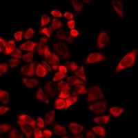 TMLHE Rabbit Polyclonal Antibody