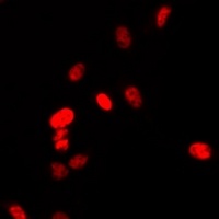 PAX6 Antibody