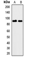 CSRP2BP Antibody
