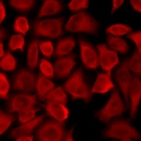Pancreatic Lipase Rabbit Polyclonal Antibody