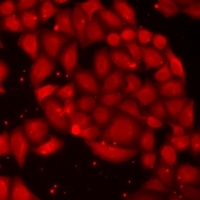 PIP4K2 alpha Rabbit Polyclonal Antibody