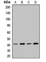 SH3GL1 Rabbit Polyclonal Antibody