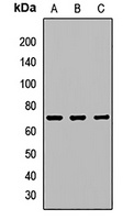IL-21R Antibody