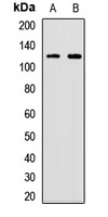 UBA6 Rabbit Polyclonal Antibody
