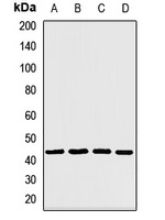 CaMK1 delta Rabbit Polyclonal Antibody