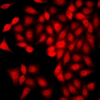 CaMK1 delta Rabbit Polyclonal Antibody