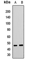 TARBP2 Rabbit Polyclonal Antibody