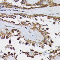 TARBP2 Rabbit Polyclonal Antibody