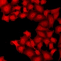 TARBP2 Rabbit Polyclonal Antibody
