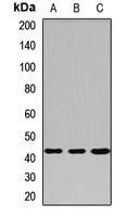 PRMT6 Rabbit Polyclonal Antibody