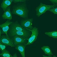 PRMT6 Rabbit Polyclonal Antibody