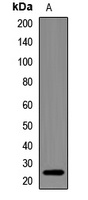 NDUFS7 Rabbit Polyclonal Antibody