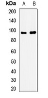 Sortilin Rabbit Polyclonal Antibody
