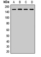 SAF-B1 Rabbit Polyclonal Antibody
