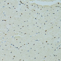 SAF-B1 Rabbit Polyclonal Antibody