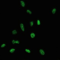 SAF-B1 Rabbit Polyclonal Antibody