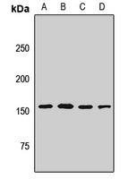 HELIC1 Rabbit Polyclonal Antibody
