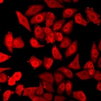 HELIC1 Rabbit Polyclonal Antibody