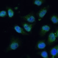 CPS1 Rabbit Polyclonal Antibody
