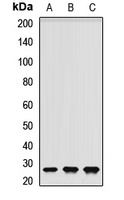 RNF166 Rabbit Polyclonal Antibody