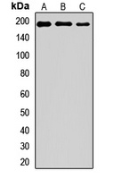 PARP4 Rabbit Polyclonal Antibody