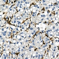 CD163 Rabbit Polyclonal Antibody