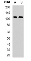 DSPP Rabbit Polyclonal Antibody