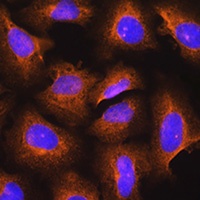 DSPP Rabbit Polyclonal Antibody