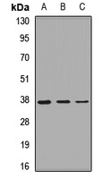GNB2 Antibody