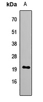 GNRH2 Rabbit Polyclonal Antibody