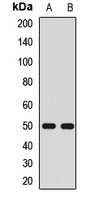 Kir2.3 Rabbit Polyclonal Antibody