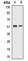 MEIS2 Rabbit Polyclonal Antibody