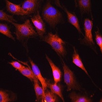 NEFH Rabbit Polyclonal Antibody