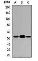 ST13 Rabbit Polyclonal Antibody