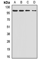 SMEK1 Rabbit Polyclonal Antibody