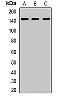 EHMT1 Rabbit Polyclonal Antibody