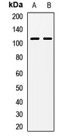 NAA25 Rabbit Polyclonal Antibody