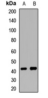 RNF34 Rabbit Polyclonal Antibody