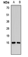 RMI2 Rabbit Polyclonal Antibody