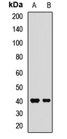 FcRn Rabbit Polyclonal Antibody
