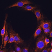 FcRn Rabbit Polyclonal Antibody