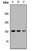 UTY Rabbit Polyclonal Antibody