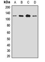 SART1 Rabbit Polyclonal Antibody