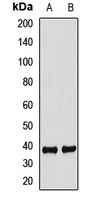 FBXO2 Rabbit Polyclonal Antibody