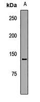 HFM1 Rabbit Polyclonal Antibody