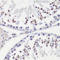 HFM1 Rabbit Polyclonal Antibody